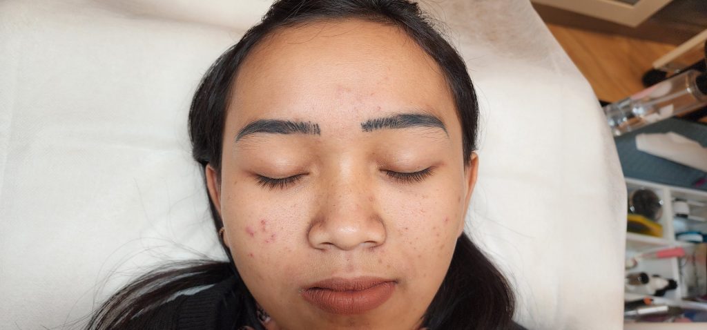 Sulam Alis Gagal